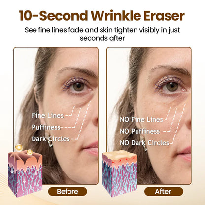 Anti-Wrinkle Corrective Serum